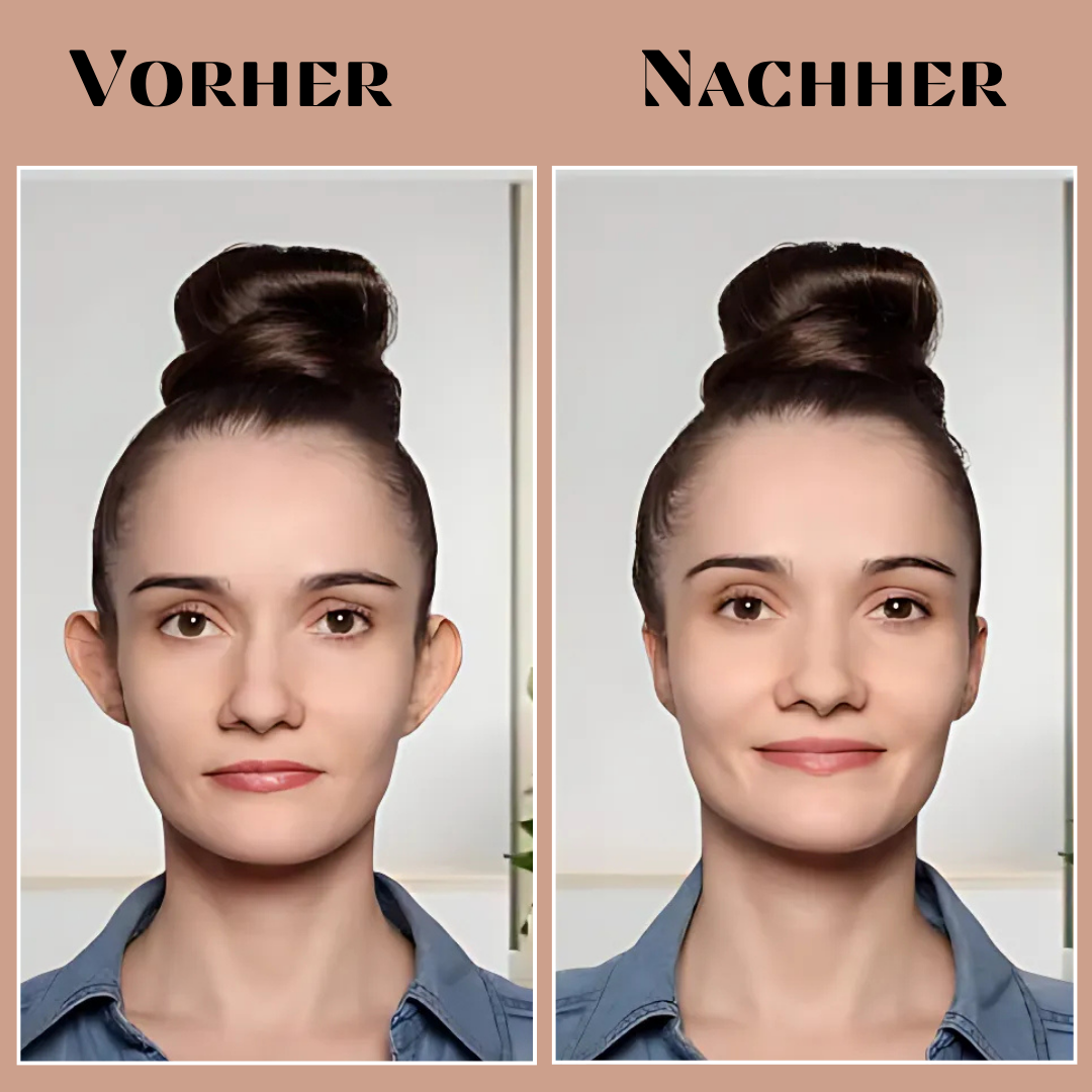 EarAlign ™ -  Comfortable Ear Shaping Patches